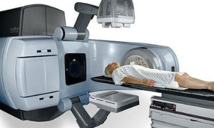 IGRT - Image-Guided Radiation Therapy